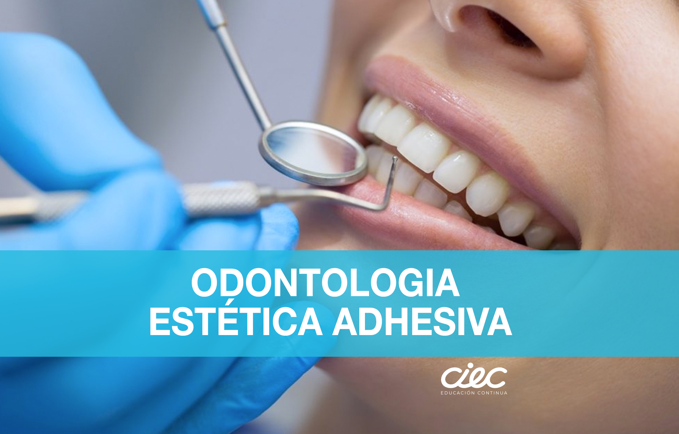 DIPLOMADO EN ODONTOLOGÍA ESTÉTICA ADHESIVA