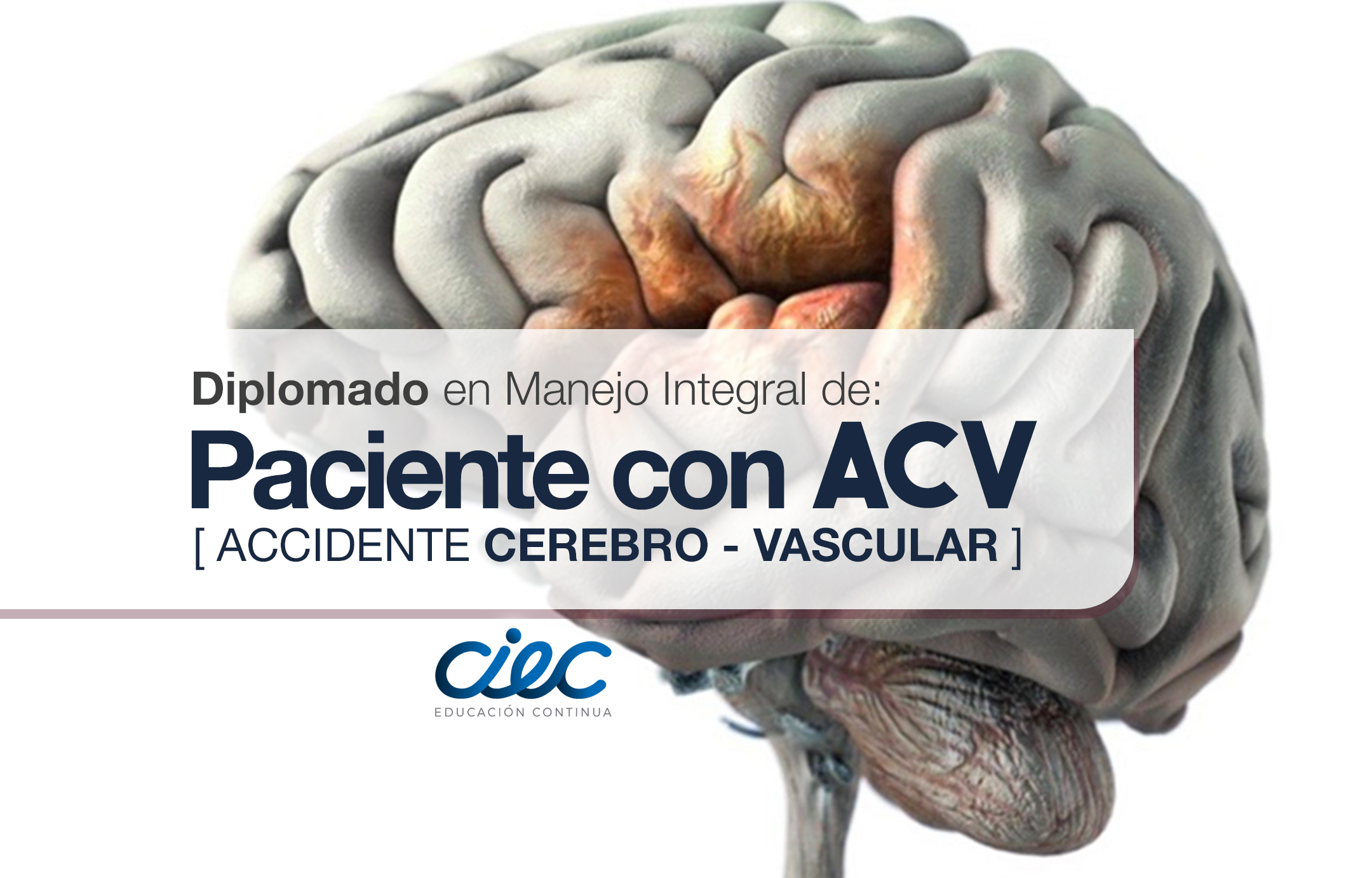 DIPLOMADO EN MANEJO INTEGRAL DE PACIENTES CON ACCIDENTES CEREBRO - VASCULAR (ACV)