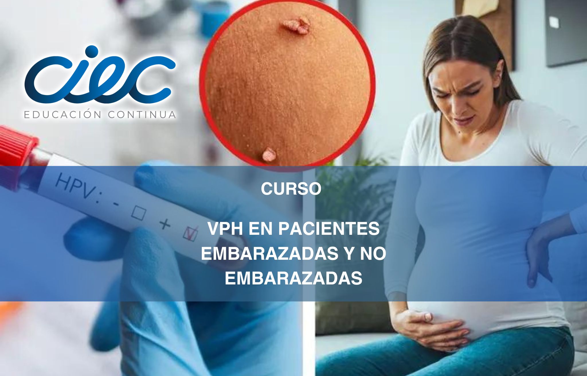 CURSO VPH EN PACIENTES EMBARAZADAS Y NO EMBARAZADAS