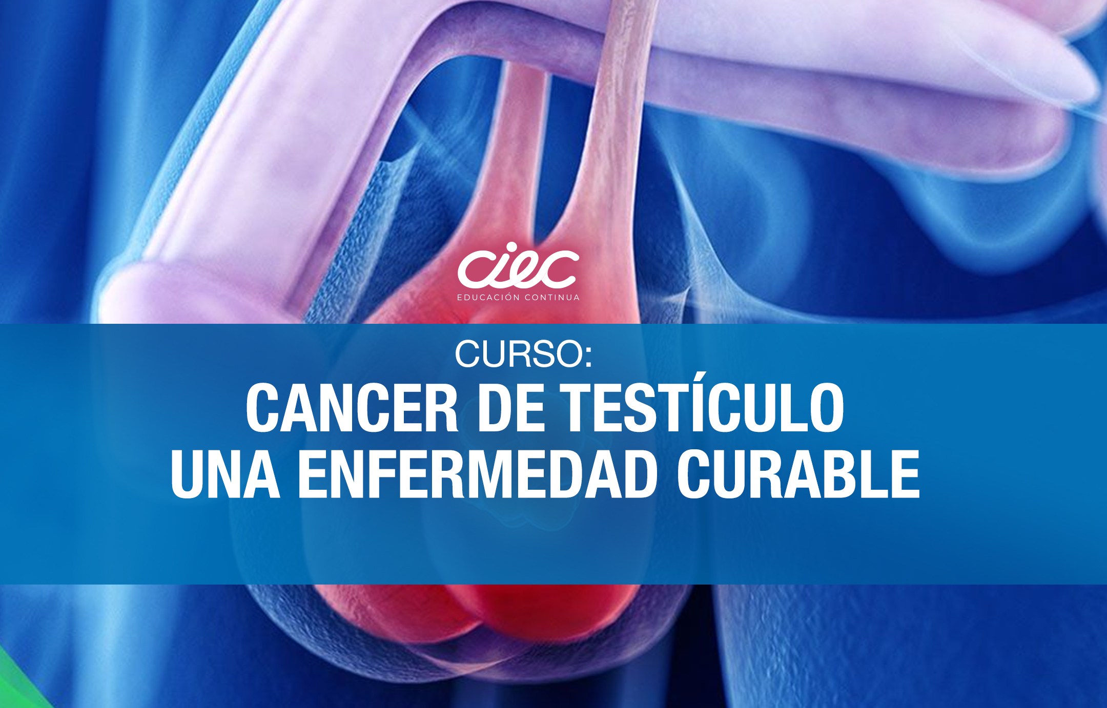 CURSO CÁNCER DE TESTÍCULO UNA ENFERMEDAD CURABLE