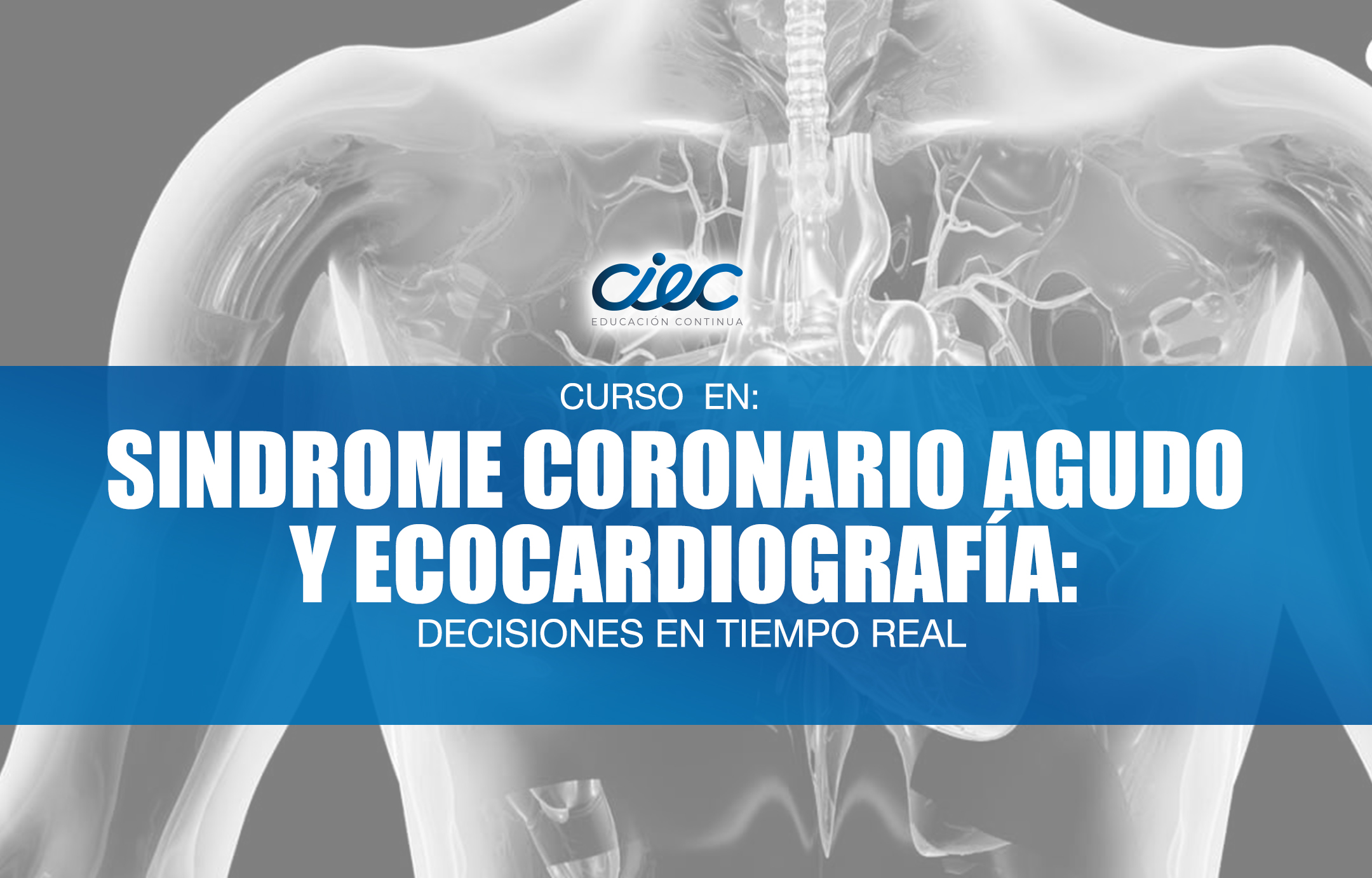 WEBINAR "Síndrome Coronario Agudo y Ecocardiografía: Decisiones en Tiempo Real"