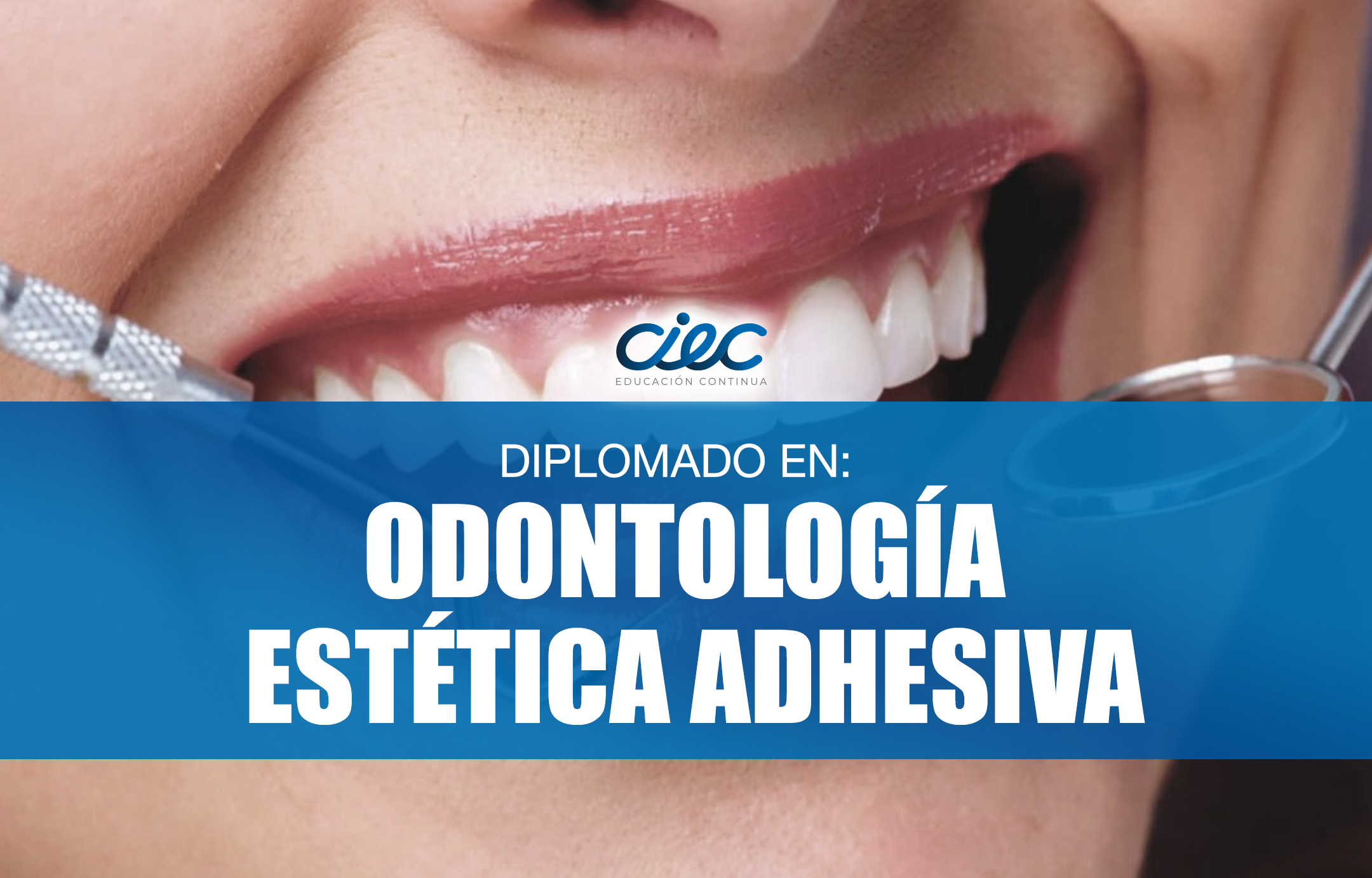 DIPLOMADO EN ODONTOLOGÍA ESTÉTICA ADHESIVA