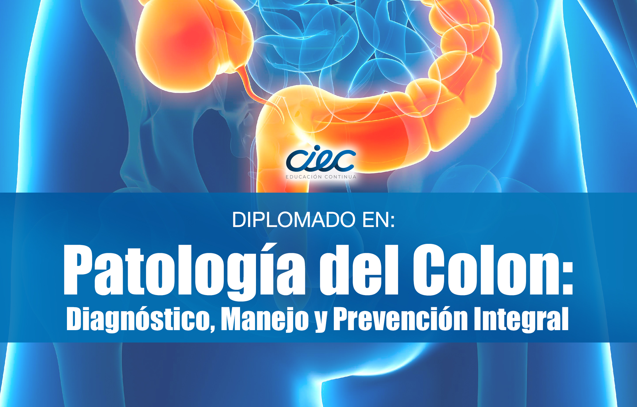Diplomado Superior en Patología del Colon: Diagnóstico, Manejo y prevención integral