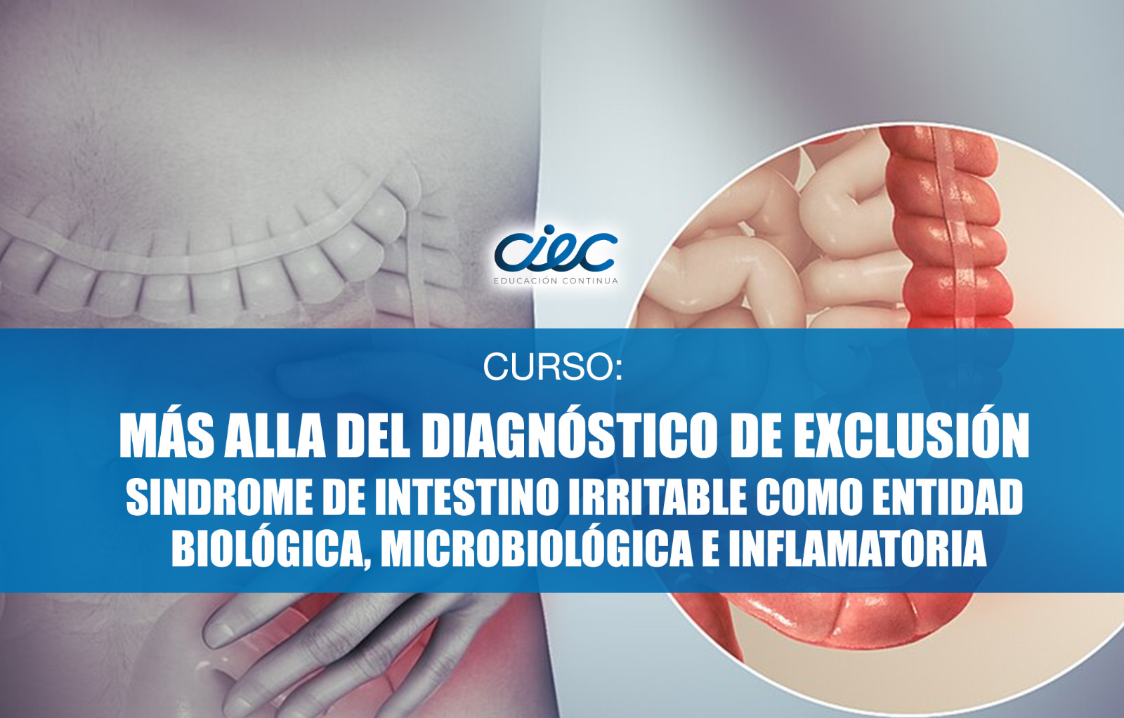 WEBINAR - “Más allá del diagnóstico de exclusión: síndrome de intestino irritable como entidad biológica, microbiológica e inflamatoria”