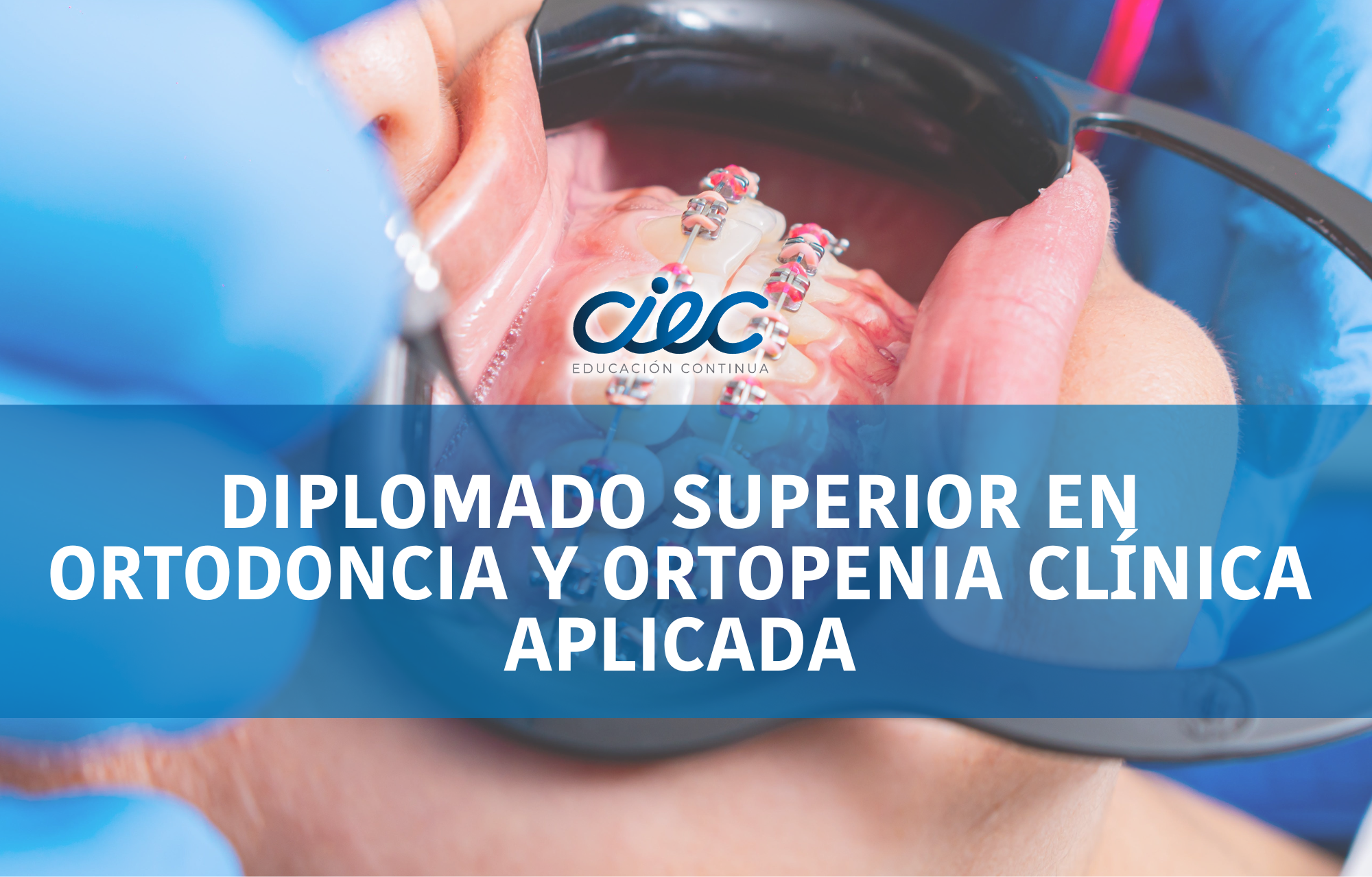 Diplomado Superior en Ortodoncia y Ortopedia Clínica Aplicada